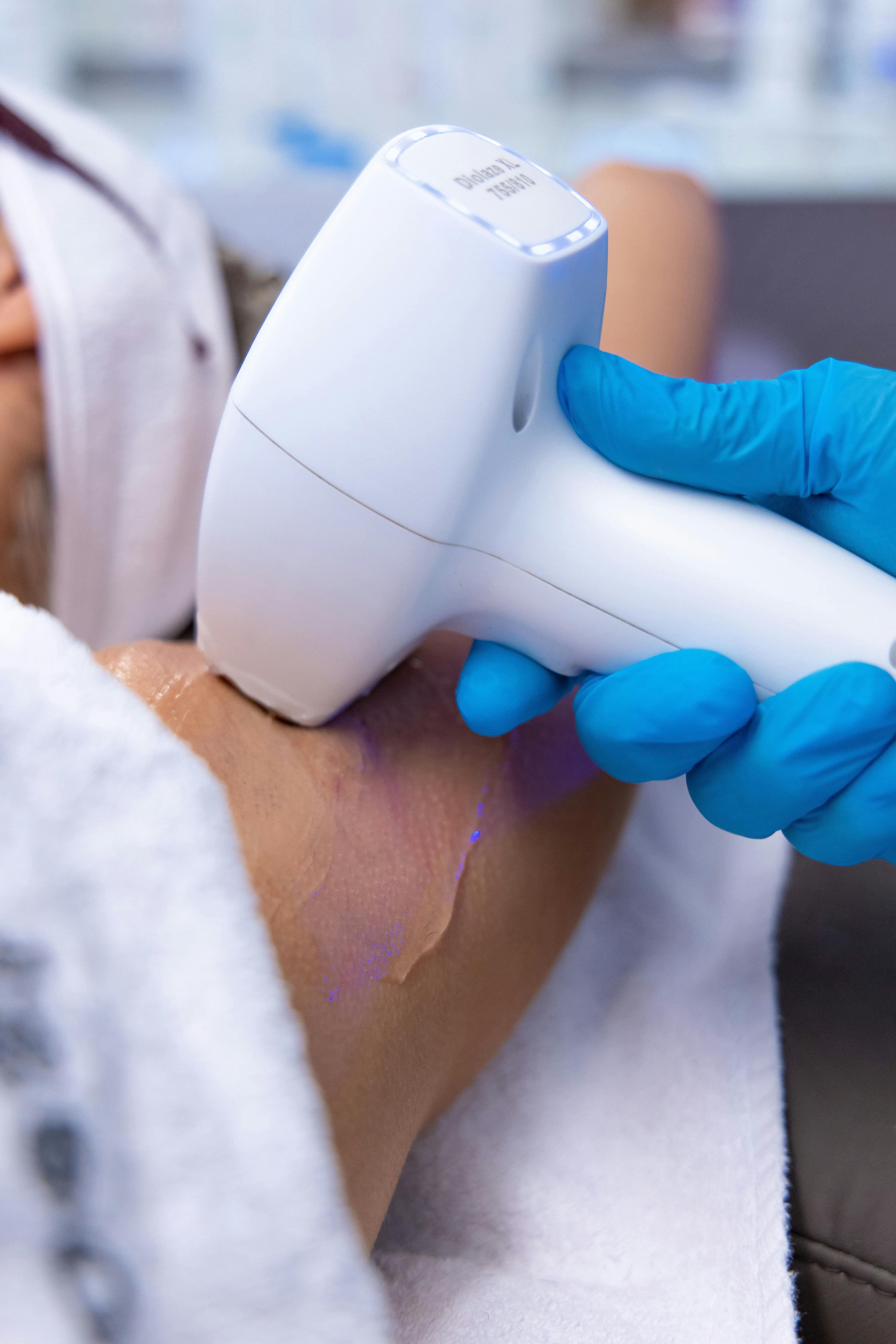 Haarfreie Achseln mit moderner Laserbehandlung in Steyr