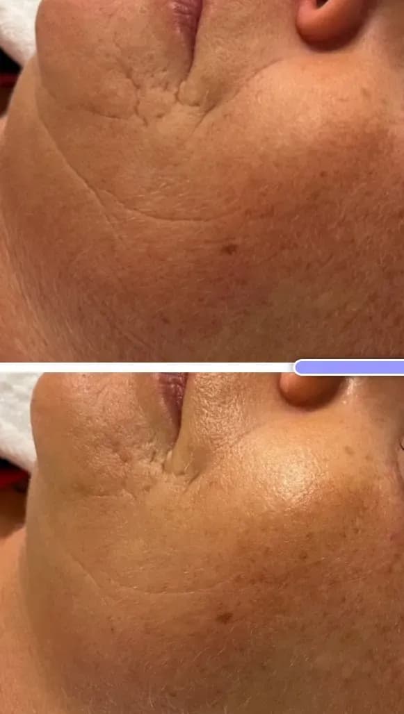 Professionelle Anti Aging Gesichtsbehandlung