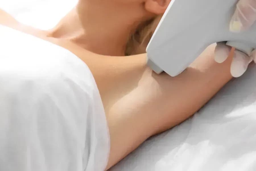 Wann ist eine Haarentfernung mit Diodenlaser sinnvoll?