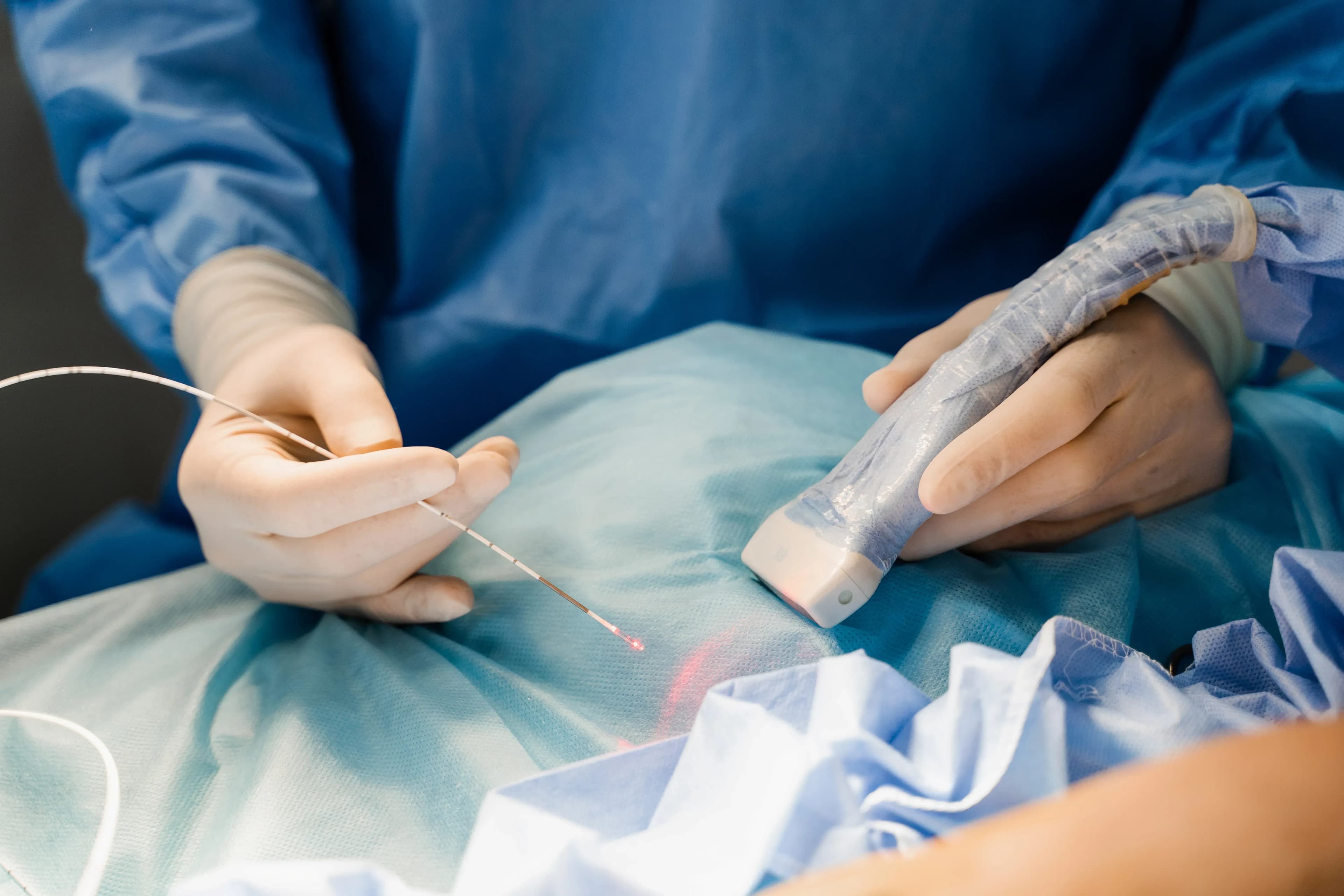 Krampfadern entfernen mit Laser – Wie funktioniert die Behandlung?